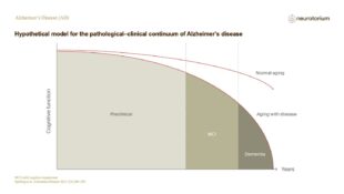 Alzheimers Disease – Diagnosis and Definitions – slide 10